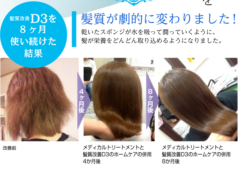 髪質改善 D3を8ヶ月使い続けた結果、髪質が劇的に変わりました!乾いたスポンジが水を吸って潤っていくように、 髪が栄養をどんどん取り込めるようになりました。