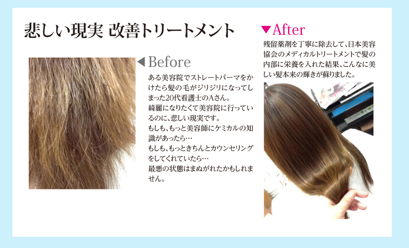 悲しい現実 改善トリートメント。ある美容院でストレートパーマをかけたら髪の毛がジリジリになってしまった20代看護士のAさん。 綺麗になりたくて美容院に行っているのに、悲しい現実です。 もしも、もっと美容師にケミカルの知識があったら… もしも、もっときちんとカウンセリングをしてくれていたら… 最悪の状態はまぬがれたかもしれません。